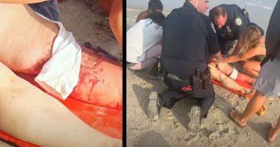 Первый случай почти за 70 лет: в США акула напала на украинку (видео)