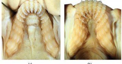 С рогами и зубами, как у людей. В Австралии обнаружили очень странный новый вид акул (фото)