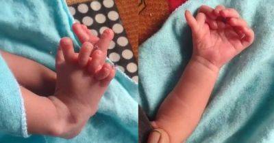 Реинкарнация богини: в Индии родилась девочка с 26 пальцами на руках и ногах (видео)