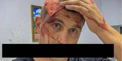 В Мариуполе ударили ломом по голове российского политика и активиста — фото
