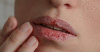 Без шелушения и трещин: как правильно ухаживать за губами зимой
