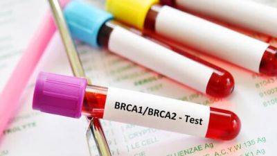 Почему в Израиле врачи направляют женщин на анализ BRCA