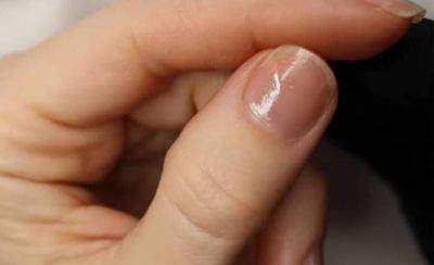 Почему слоятся ногти и как это решить: действенные рекомендации