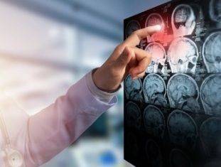 Ученые напечатали ткань человеческого мозга - novostiua.net