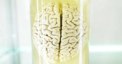 Научный прорыв. Мозг оставался живым в течение 5 часов вне тела: как ученым это удалось - focus.ua - Техас