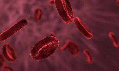 Человеческая кровь становится зеленой – ученые показали интересное видео