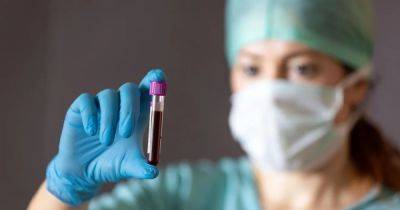 Определяет рак поджелудочной железы с точностью 97%: ученые представили новый анализ крови