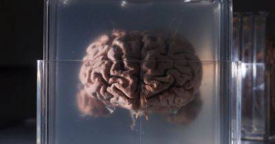 Ученые успешно заморозили и разморозили кусок человеческого мозга: подробности эксперимента