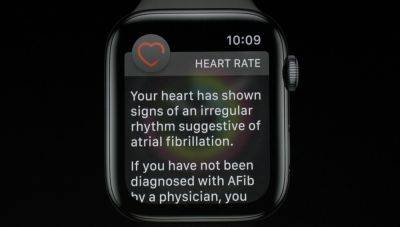 Продюсер Peloton заявила, что Apple Watch помогли диагностировать у неё заболевание сердца
