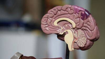 Neuralink получила разрешение FDA на проведение второй операции по вживлению мозговых имплантатов