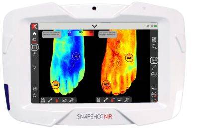 Портативное устройство для диагностики "Snapshot NIR" заменит ультразвук и рентген